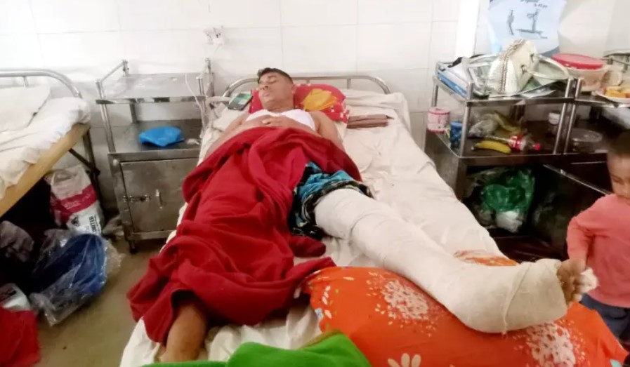 বরিশালে নিজ দলের প্রতিপক্ষের হাতুড়ি পেটায় শ্রমিক দল নেতা আহত
