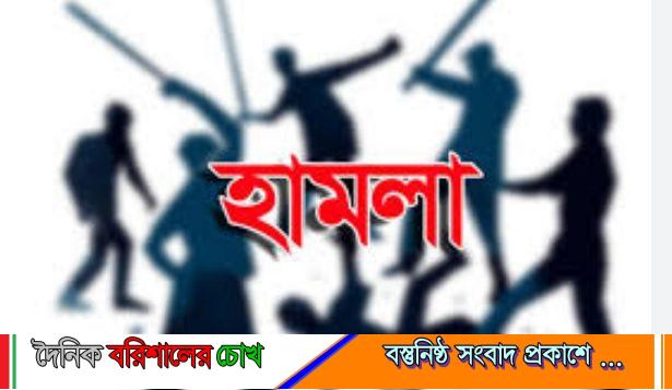 কাঠালিয়ায় ইউপি মেম্বারের বসত ঘরে হামলা,গৃহবধুর শরিরে আগুনে ঝলসে দেয়ার অভিযোগ!!