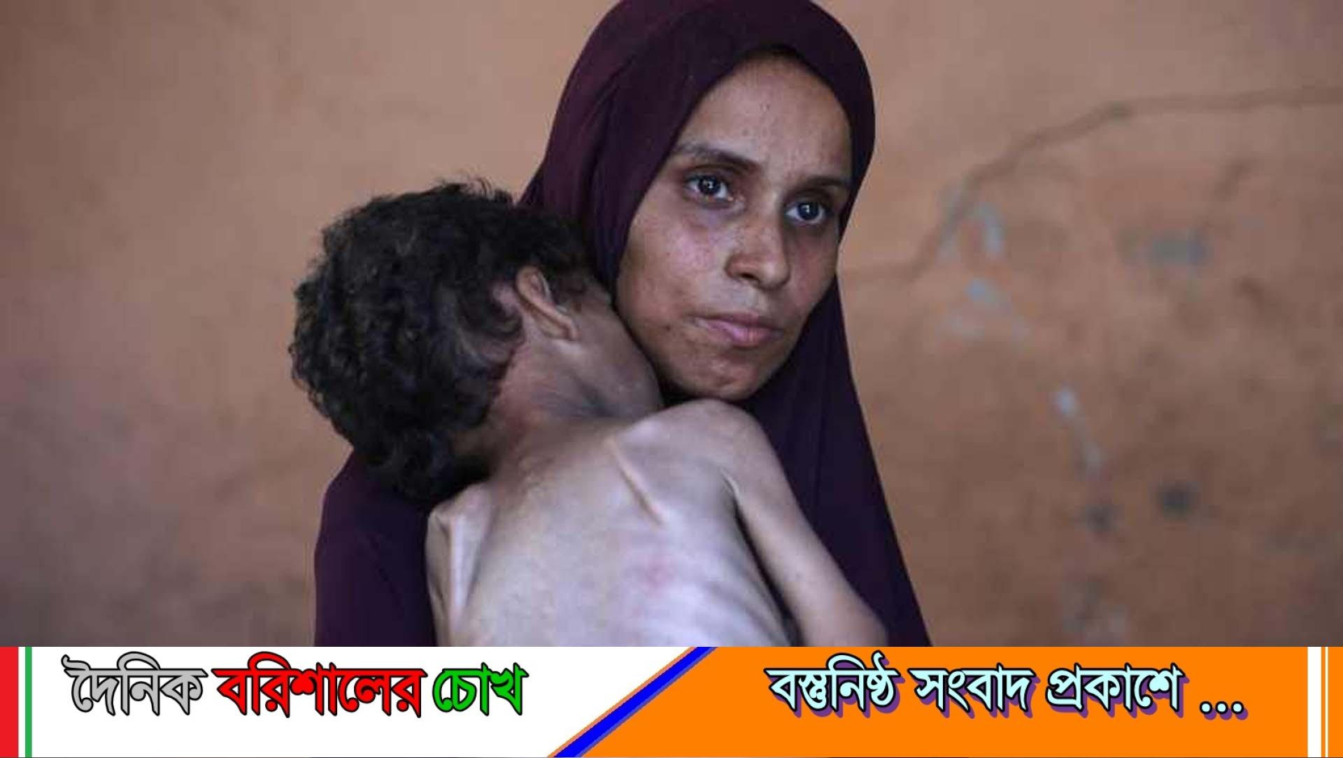 গাজায় না খেয়ে ১৪ জনের মৃত্যু