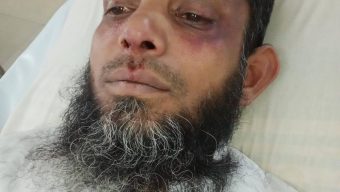 কাশিপুরে রাজনৈতিক সহিংসতা: বিএনপি নেতার হামলায় জামায়াতকর্মী আহত
