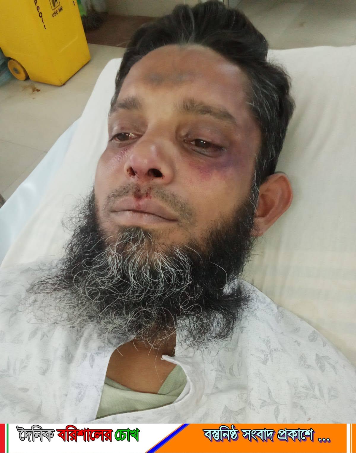 কাশিপুরে রাজনৈতিক সহিংসতা: বিএনপি নেতার হামলায় জামায়াতকর্মী আহত