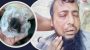 ​ফেনীতে জামায়াত কর্মীর দাড়ি উপড়ে পৈশাচিক হামলা, অভিযুক্ত যুবদল কর্মী পলাতক