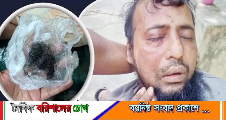 ​ফেনীতে জামায়াত কর্মীর দাড়ি উপড়ে পৈশাচিক হামলা, অভিযুক্ত যুবদল কর্মী পলাতক