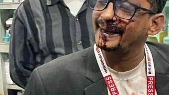 সোনাইমুড়ীতে ব্যালটে সিল মারার দৃশ্য ধারণকালে সাংবাদিককে পিটিয়ে জখম