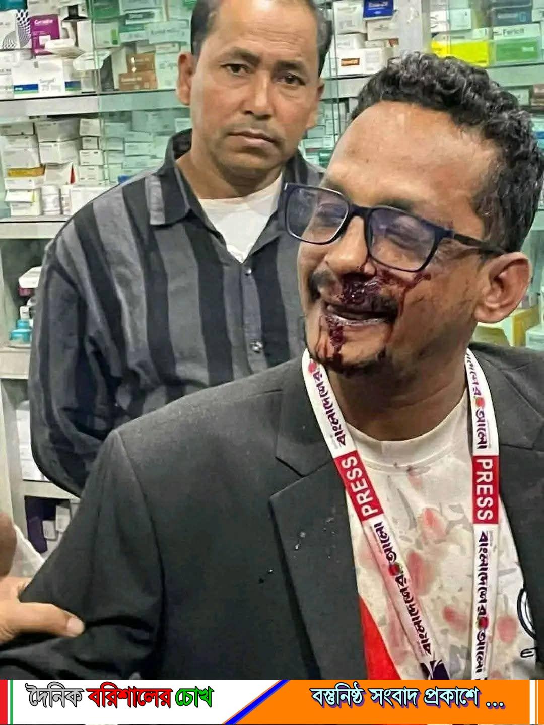 সোনাইমুড়ীতে ব্যালটে সিল মারার দৃশ্য ধারণকালে সাংবাদিককে পিটিয়ে জখম