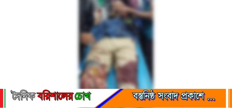 বরিশালে ছাত্রদল সভাপতিকে কুপিয়ে জখম: অবস্থার অবনতি হওয়ায় ঢাকায় স্থানান্তর